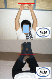 腰痛（格闘技中に起きた）の改善例