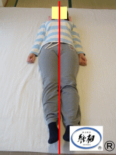ねこ背（猫背）、足のつけ根（股関節）の痛みの改善例