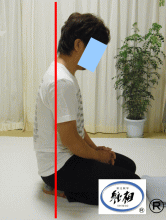腰痛（ぎっくり腰）のゆがみの改善例