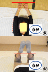腰痛（ぎっくり腰）、肩凝り（肩こり）の改善例